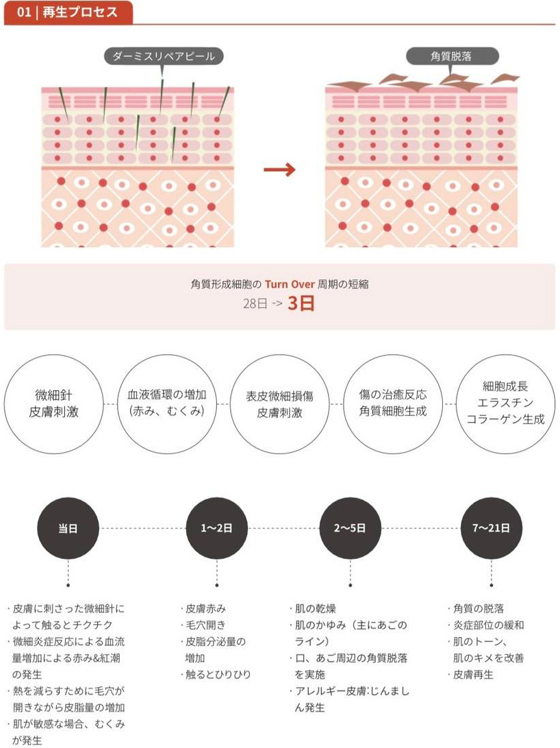 再生プロセス